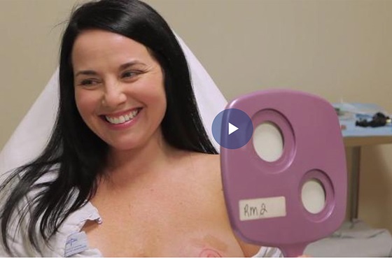 Video thumbnail for Emily's patient story about nipple tattoos after a mastectomy